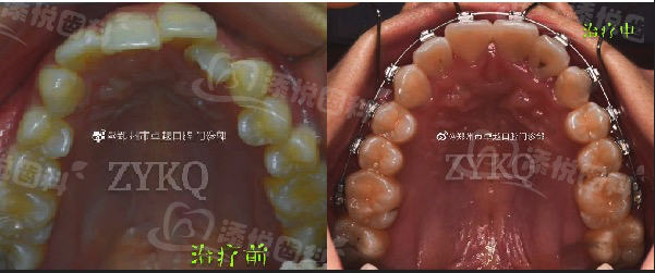 郑州卓越口腔医院