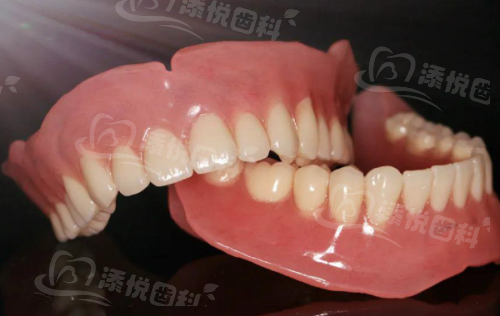 广州广大口腔2025价格怎么样？种植牙3999元起