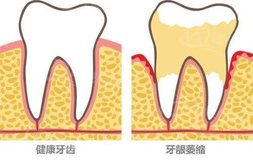 珠海诺贝尔口腔门诊部价格表怎么样？性价比超高，项目丰富！ 