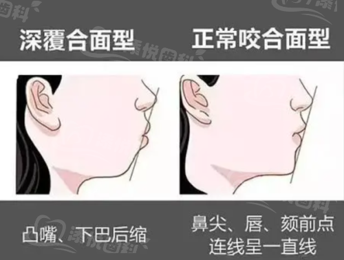 广州暨穗口腔门诊部收费价格表怎么样？价格合理透明，项目丰富！ 