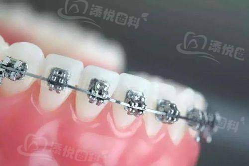 西安中诺口腔医院收费贵吗？不贵！洁牙136元起，多种项目价格实惠很靠谱！ 