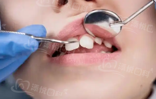 二、北京瑞泰口腔医院技术怎么样？