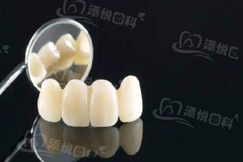 江门壹心维美口腔门诊部收费标准如何？合理实惠，技术优服务好！ 