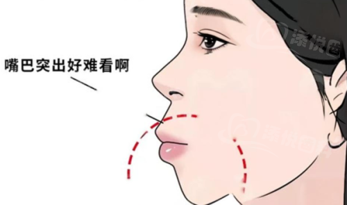 惠州精英惠口腔门诊部收费标准如何？价格合理透明，技术专业靠谱！ 