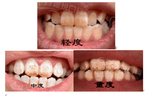 重庆名博士口腔价格表揭秘！牙齿矫正5699元起，多种项目实惠，患者满意度高！ 