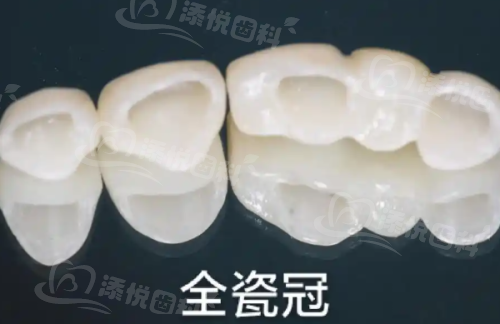 郭云岚