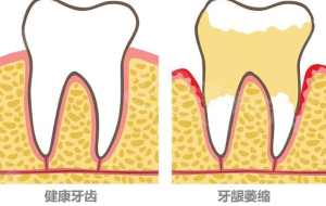鄂尔多斯中诺口腔医院收费标准：种植牙2580元起、矫正7800元起