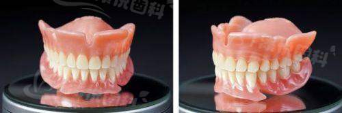 济南韩氏整形口腔医院种植牙价格有优惠！即刻种牙免手术和植骨费，种植体降1000 - 6000元，学生教师别错过！ 