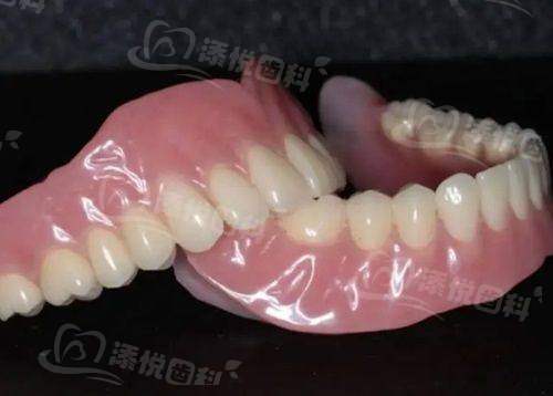 石家庄中诺口腔医院价格表揭秘！种植牙1880元起、矫正5000元起，项目实惠超心动！ 
