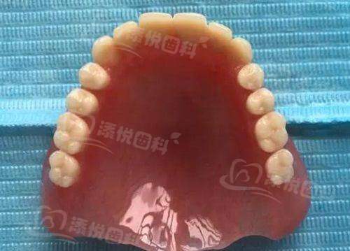 咸阳秦都海涛口腔医院价格表揭秘！洗牙128元、种植牙3888元起，收费透明超划算！ 