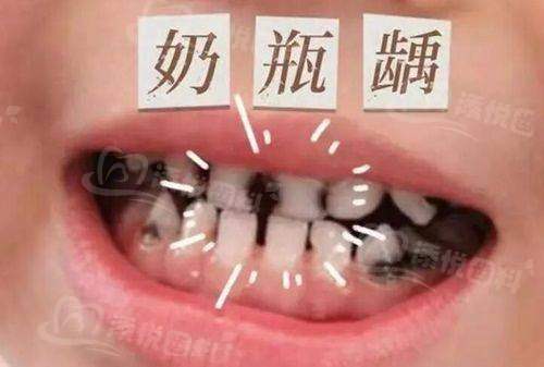 珠海诺恩口腔诊所价格表揭秘！项目丰富价格合理，种牙正畸性价比超高，满足多样需求！ 