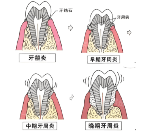 三、深圳爱康健口腔医院的收费标准www.tyck.cn