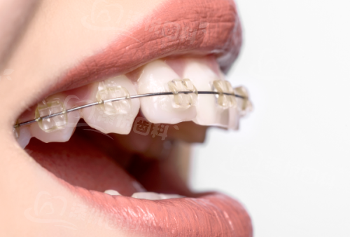 四、泉州美特尔口腔医院技术优势及患者反馈www.tyck.cn