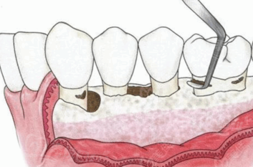 二、烟台白玉口腔医院的特色项目与技术优势www.tyck.cn