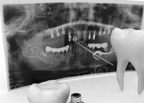 三、德州德诺口腔医院的口碑评价www.tyck.cn