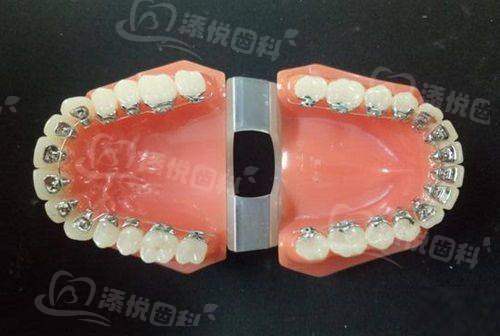 三、福州看牙预约流程www.tyck.cn