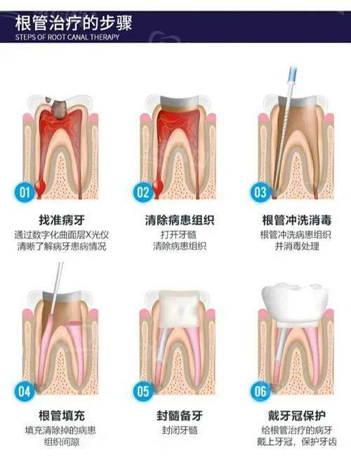 三、西安团圆口腔医院价格贵不贵www.tyck.cn