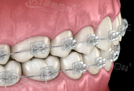 三、运城看牙怎么预约更划算www.tyck.cn