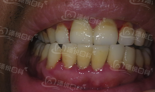 重庆正舸口腔诊所价格表揭秘？种牙矫正透明收费，口碑好技术强让人放心！