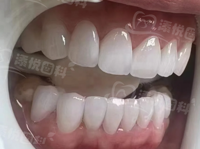 二、重庆种牙医院排名前十参考www.tyck.cn