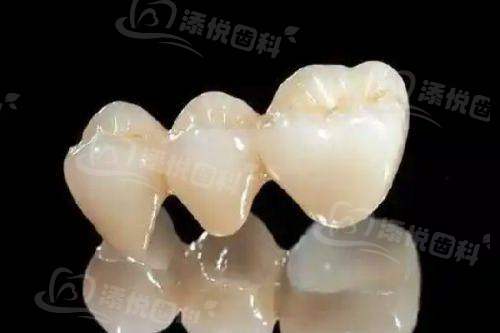 二、合肥中诺口腔矫正价格与项目详解www.tyck.cn