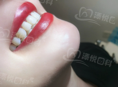 二、吴江汾湖看牙哪家医院正规