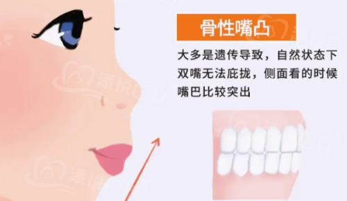 一、佛山博德口腔门诊部价格表?