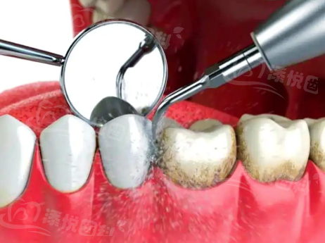 一、佛山博德口腔门诊部是正规的吗深度解析