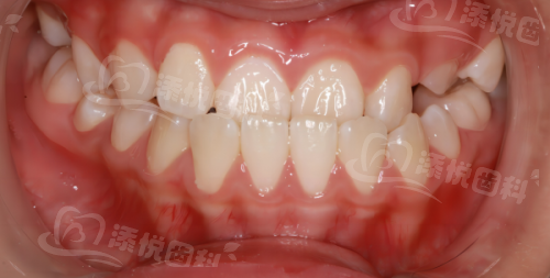 www.tyck.cn