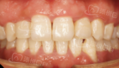 www.tyck.cn